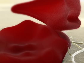 Eritocito en forma de huso propio de la anemia falciforme y glóbulo rojo normal infectado de malaria.